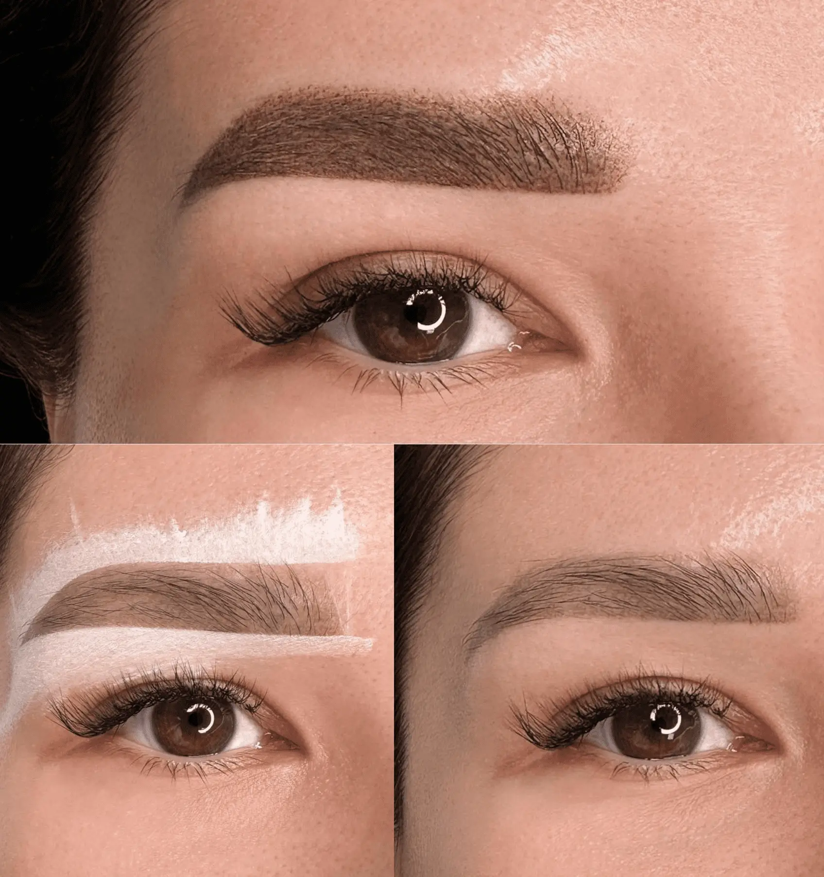 Cosmetic tattooing​